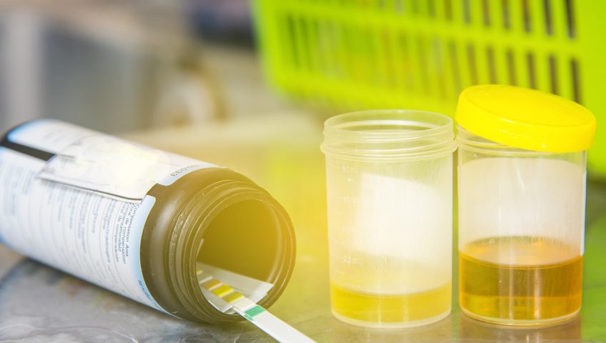 Urine Drug Tests